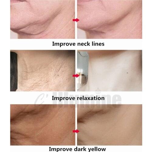 Beauty Neck Cream Tighten Remove Neck Lines Fade Fine Lines Neck Whiten Neck Care Non Spanish Neck Cream OEM 300g Beauty Salon