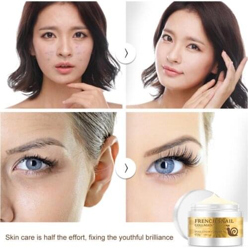 LAIKOU Snail Face Cream Acne Scar Removal Whitening Stretch Mark Anti Wrinkle Aging Nourishing Hyaluronic Acid Serum Cream TSLM1