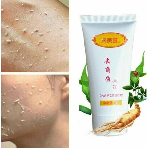 Ginger Exfoliating Gel Cleanser Nourishing Cleanser Hyaluronic Acid Scrubs Dead Skin Removal Gel Skin Care