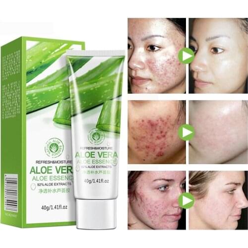 BIOAQUA Aloe Vera Gel Face Cream Hyaluronic Acid Anti Winkle Whitening Moisturizing Acne Treatment Cream Skin Care