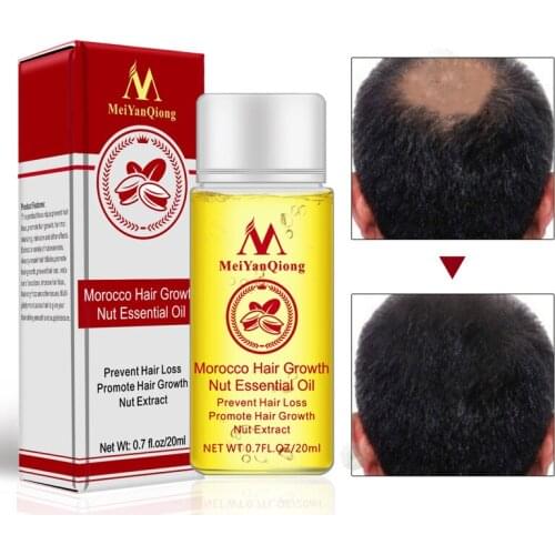 Powerful Hair Growth Oil Prevent Hair Loss Products Essence Liquid Treatment For Men And Women Repair Shampoo Hair Care 20ml