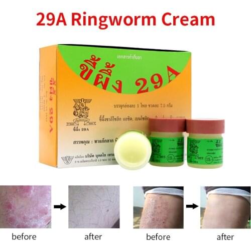 Psoriasis Eczma Cream Works Perfect For All Kinds Of Skin Problems Patch Body Massage Ointment 1pc