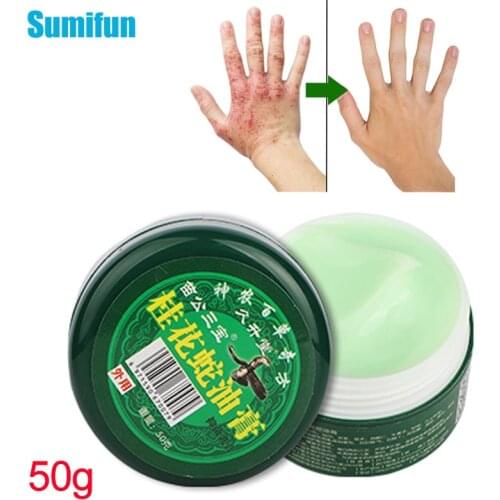50g Antibacterial Cream Anti-itch Dermatitis Eczema Pruritus Mosquito Bites Antipruritic Ointment Herbal Plaster Skin Care Cream