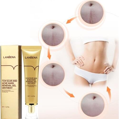 LANBENA ginseng extract against black dots cream scar removal facial blackhead acne skin care treatment bleaching cream 30ml