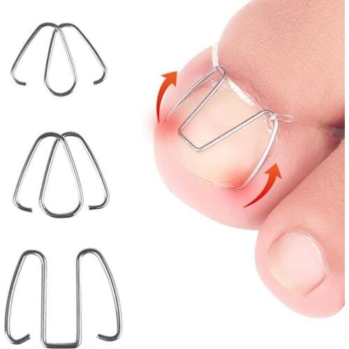 1 Set Toenail Fixer Anti-rust Professional Iron Ingrown Foot Care Tool for Foot Care