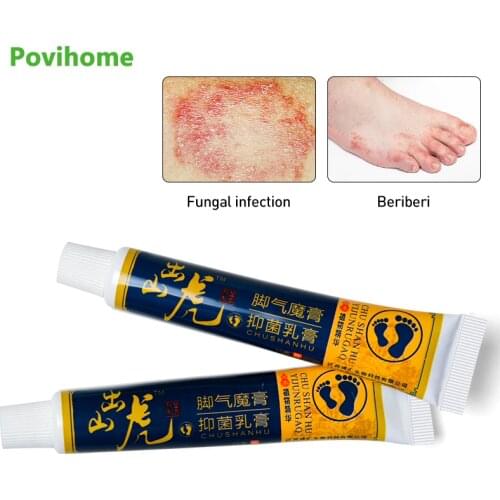 2pcs Anti Fungal Infections Foot Cream For Athletes Foot Blisters Relief Erosive Beriberi Itch Ointment Peeling Feet Herb Cream