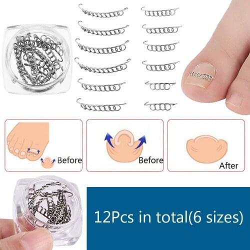 12Pcs/box Toenails Correction Wire Recover Care Paronychia File Patch Corrector Foot Pedicure Nail Art Tools 6 Sizes