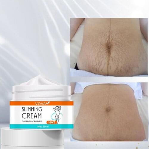 Losing Weight Slimming Body Cream Remove Stretch Marks Cream Cellulite Firming Fat Burning Massaging Slimming Body Care Products