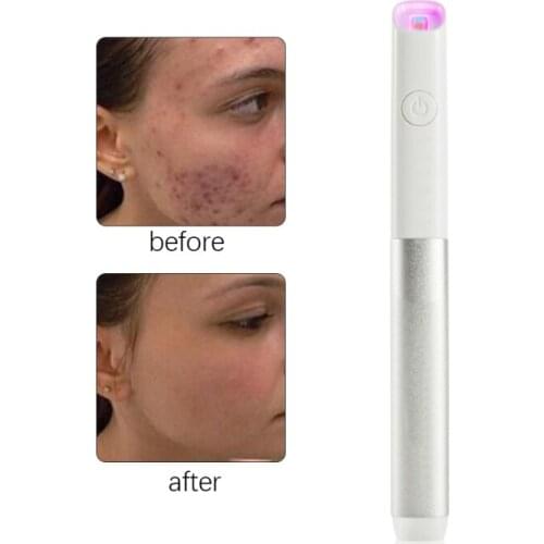 Acne Spot Laster Pen Facial Vibration Massage Instrument Electronic Negative Galvan Ion Import Export Tool Face Care Massager