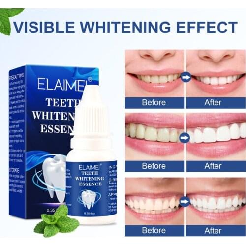 Tooth Whitening Suit Dental Plaque Cleansing Smokers Yellow Teeth Coffee Stains Teeth Whitening Essence Cotton Swabs Set TSLM1