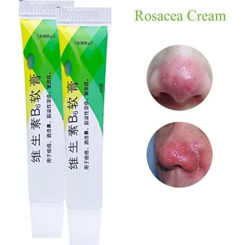 Chinese Herbal Medicine Rosacea Treatment Red Nose Acne Rosacea Ointment Remover Skin Redness Flushing Vaseline Acne Treatment
