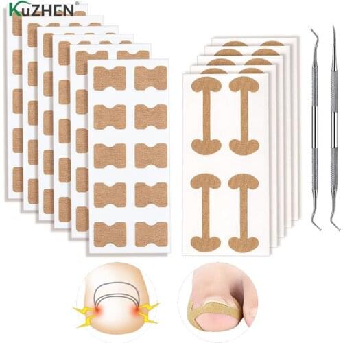 1 Set Elasticity Toe Nail Care Pedicure Tools Health Care Protects Toe Nail Professional Ingrown Toenail Foot Corrector Stickers