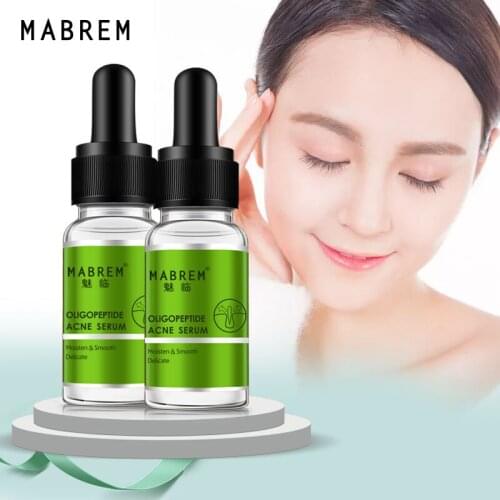 2PCS Oligopeptide Acne Cleaning Lotion Serum Face Brightening Serum Acne Scar Spots Serum Shrink Pores Eliminates Oil Control