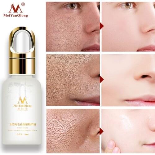 MeiYanQing Hamamelis Hyaluronic Acid Pore Shrinking Serum Whitening Moisturizing Anti-aging Replenishes Skin Moisture Essence