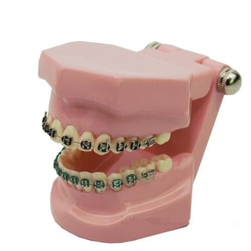 Good Quality 2016 New Arrival Orthodontic correction model Dental Teaching model free shipping
