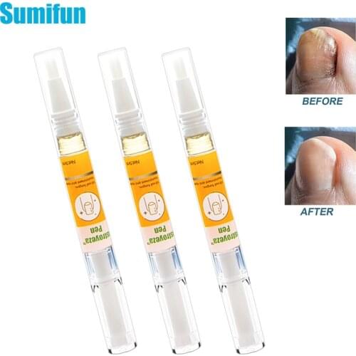 1Pcs New Fungal Nail Treatment Oil Antibacterial Repair Ointment Whitening Toe Anti Infection Nail Repair Cream Nail Care