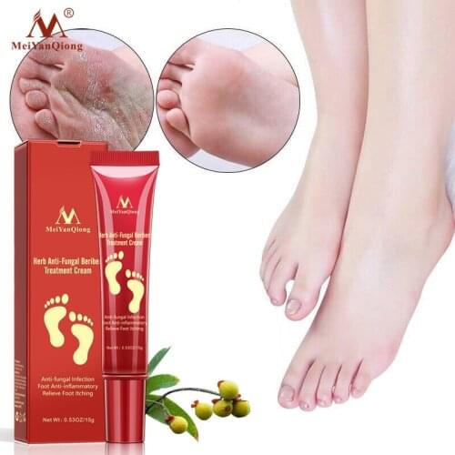MeiYanQiong Herbal Anti-Fungal Treatment Cream Relieve Foot Infection Anti-inflammatory Itching Resist Bacteria Cream Skin Care