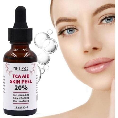 30ml New Trichloroaectic Acid 20% Skin Peel Shrink Pore Minizing Wrinkles Spots Skin Care Face Serum Hot Sale