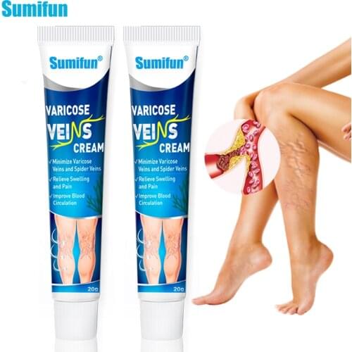 Sumifun 1/2pcs Vasculitis Phlebitis Spider Cream Varicose Veins Treatment Cream Varicosity Angiitis Removal Medical Plaster