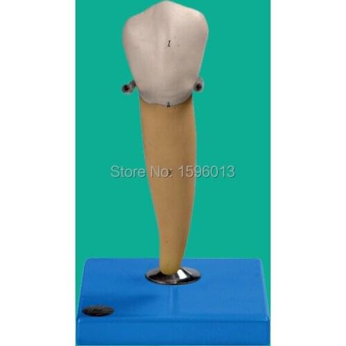 Lower Molar with One Root Model, Molar Teeth Model,dental model