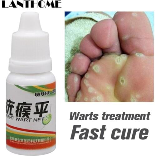 Black Dots Mole Wart Skin Tag Remover 12 Hours Tu Kill Liquid Medical Foot Corn Removal Foot Care Mole Skin Tag Removal Solution