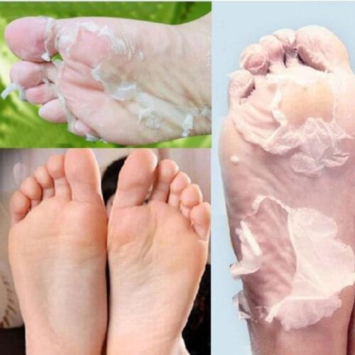 100 Pairs Exfoliating Peel Foot Masks Skin Care Remove Calluses & Dead Skin & Foot Odour No Salicylic Acid Free DHL