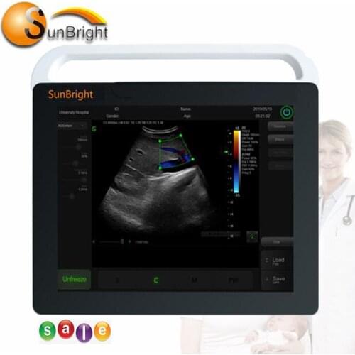 Trade assurance portable touch screen USG Black ultrasound imaging system machine portable ultrasound scanner top images