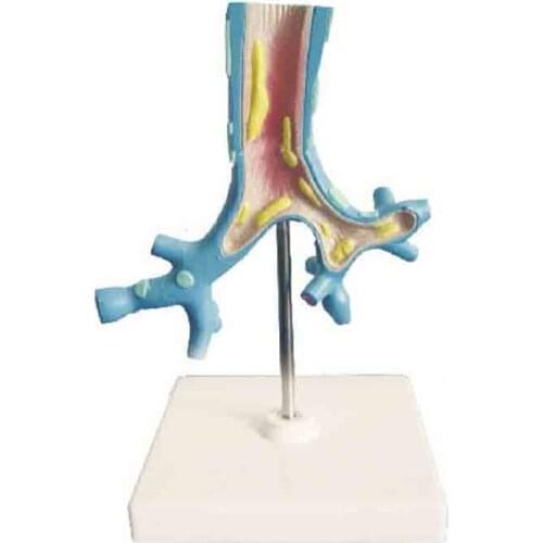 Bronchial pathological model
