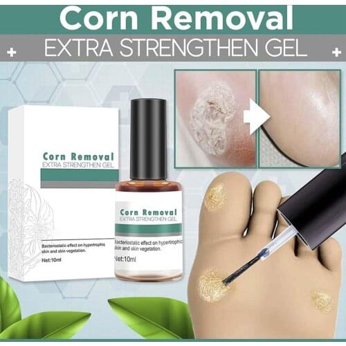 Foot Care Corns Removal Liquid Plantar Warts Skin Tags Curative Strengthen Gel Rapidly Removes Warts Corns Herbal Essential Oils