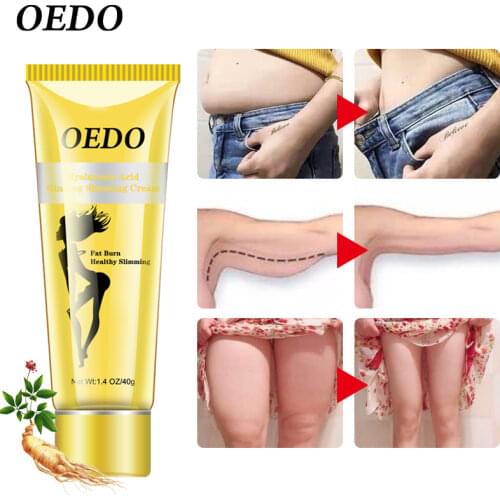 OEDO Hyaluronic Acid Ginseng Slimming Cream Reduce Cellulite Lose Weight Burning Fat Health Care Cream Body Skin Whitening Cream