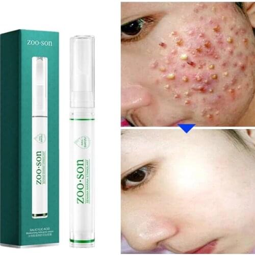 Salicylic Acid Acne Treatment Cream Blackhead Repair Gel Anti Acne Serum Oil Control Skin Care Shrink Pores Scar Whitening