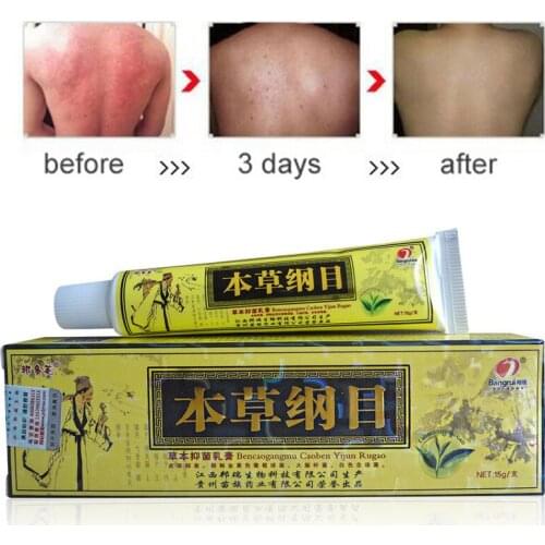 Cream for Psoriasis Advanced, cream for Psoriasis, Dermatitis and eczema, itching herbal ointment