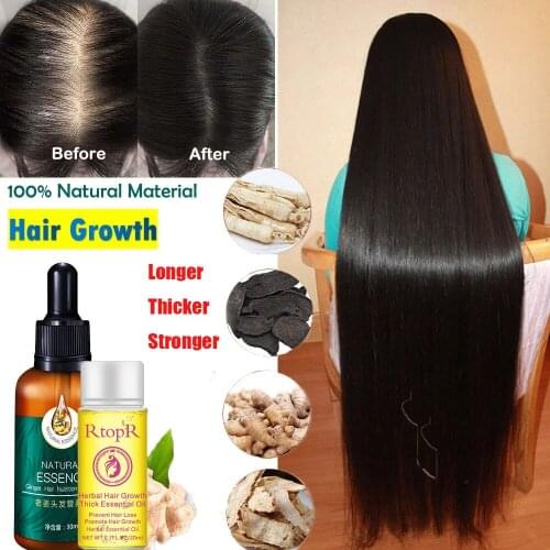 Ginger Hair Growth Essence Fast Thick For Anti-Hair Loss Damaged Hair Repair Longer Thicker Natural HairCare Product hair growth