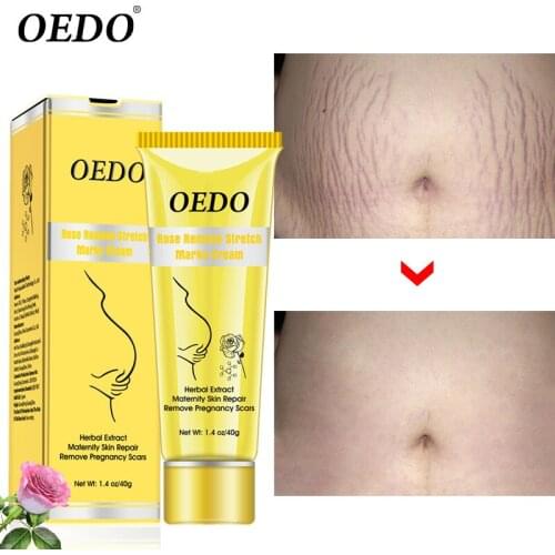 Rose Removes Stretch Mark Cream To Remove Postpartum Obesity Pregnant Women Repair Anti-Aging Anti-Winkles Firming Body Cream