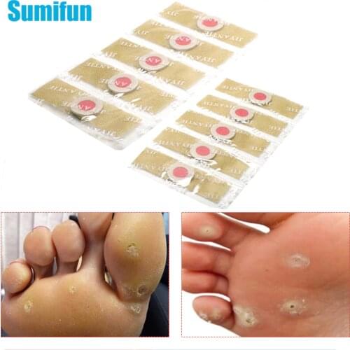 80Pcs Calluses Patch Foot Corn Removal Warts Thorn Pain Relief Pad Feet Care Medical Plaster Toe Protector Stickers Skin Cutin