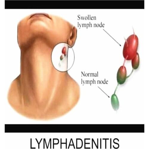 10 Pcs Neck Lymphatic Detox Patch Anti-Swelling Herbal Foot Body Relaxation MH88