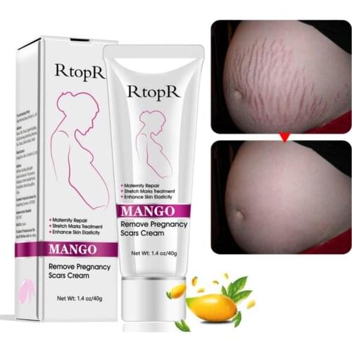 40g Remove Pregnancy Scars Acne Cream Stretch Mark Treatment Maternity Repair Anti-Aging Anti-Winkle Firming Body Cream