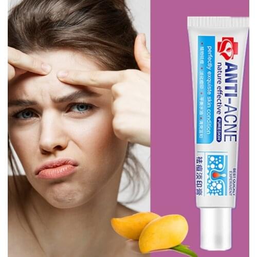 Anti-acne cream treatment cream blackhead acne cream repair gel oil control shrink pores scar facial care whitening skin 30g