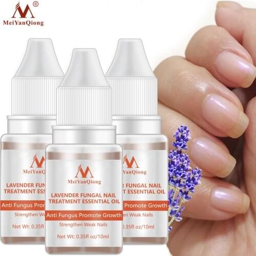 Nail Repair Essence Serum Fungal Nail Treatment Remove Onychomycosis Toe Nail Nourishing Brightening Hand And Foot Care Essence