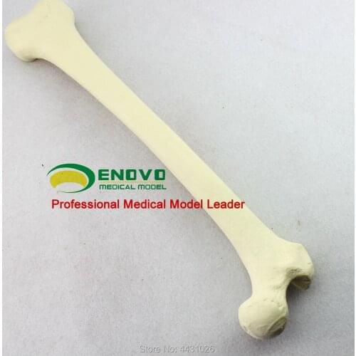 ENOVO The orthopaedic pfna operation Sawbone artificial cortical bone cancellous femoral model orthopedic implant surgery