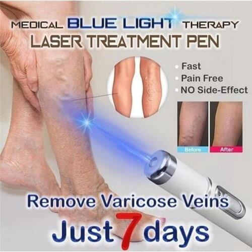 Blue Light Therapy Laser Pen for Varicose Veins Therapy Soft Scar Remover Wrinkle Removal Treatment Acne Pen Massage Relax