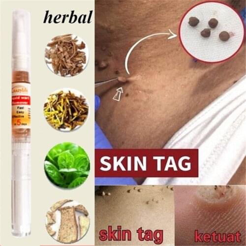 1 Piece 3ml Ultra Strength Skin Tag Remover Pen Skin Repair Pen Medical Foot Corn Skin Tag Mole & Genital Wart Remover