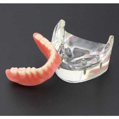 Xceldent Baking Dishes