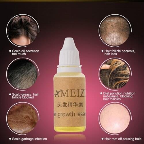 20 ML Hair Growth Essence Hair Loss Liquid dense hairs fast sunburst grow Ginger repairs scalp damage hairs care