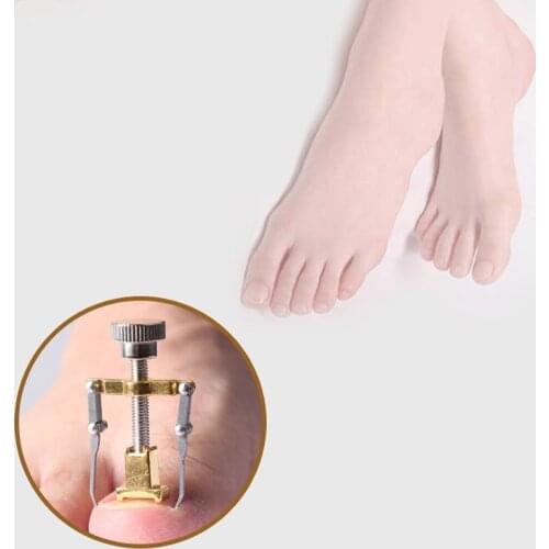 Treatment Ingrown Toenail Paronychia Correction Tools Professional Pedicure Nail Care Tools Orthotic Toe Nail Supplies