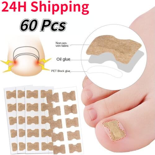 10Pcs Ingrown Toenail Corrector for Paronychia Care Toe Nail Treatment Sticker Correction Recover Patch Foot Inserts Health Care