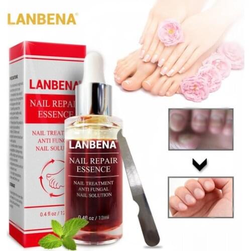 LANBENA Fungal Nail Repair Serum Care Treatment Foot Nail Fungus Removal Gel Anti Paronychia Onychomycosis