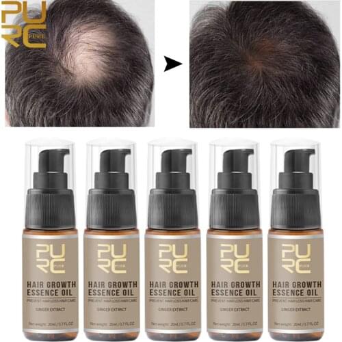 PURC 5pcs Hair Growth Oil for Thinning Hair Ginseng Ginger Prevent Hair Loss Serum Scalp Treatments Hair Care