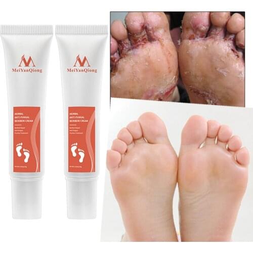 LAIKOU Foot Gels