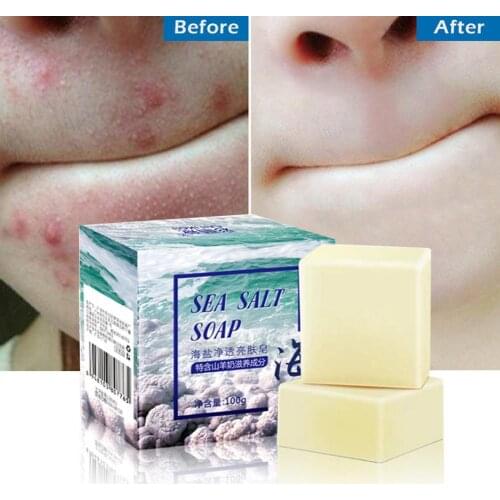 Sea Salt Soap For Face Whitening Moisturizing Remove Cleaning Natural Bath Pimple Care Shower Soap Deep L2O8